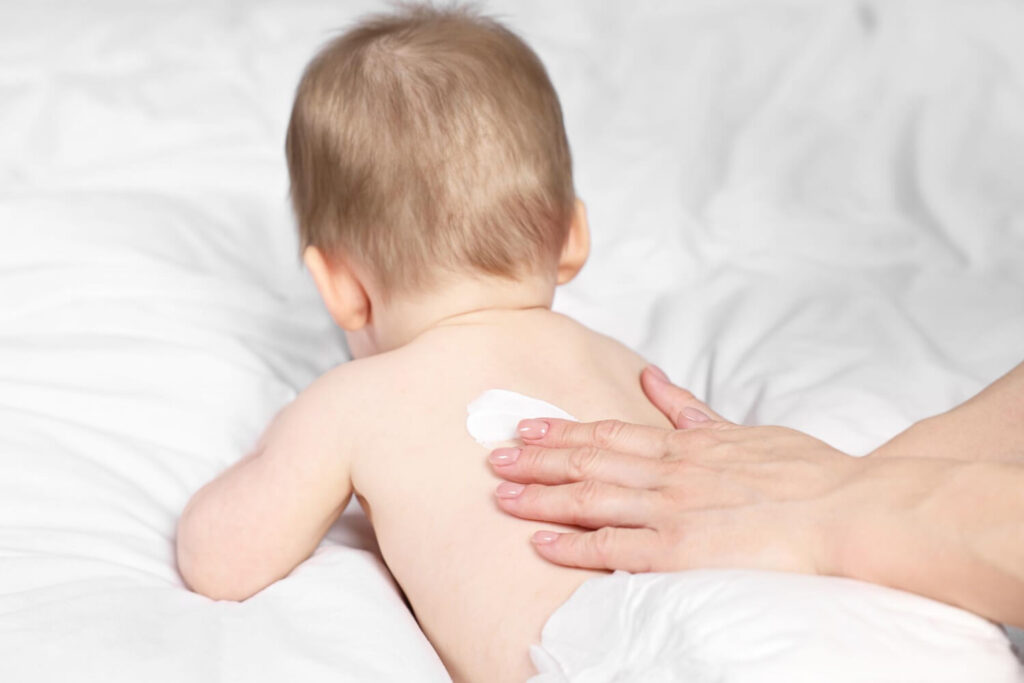 maman applique liniment sur le dos de bébé
